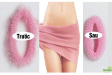 Cách làm se khít âm đạo